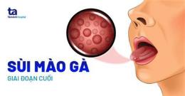 ảnh chụp màn hình chua sui mao ga o benh vien da lieu trung uong