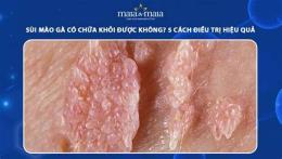 ảnh chụp màn hình có ai đã chữa khỏi sùi mào gà?