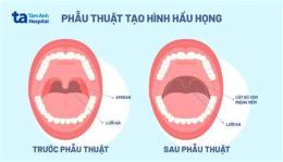 ảnh chụp màn hình gà đá hầu kiềng là như thế nào