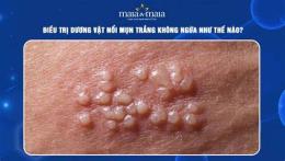 ảnh chụp màn hình nổi mụn như da gà
