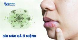 ảnh chụp màn hình sui mao ga benh vien da