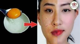 ảnh chụp màn hình tác dụng của trứng gà với da mặt