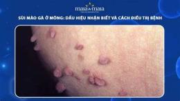 ảnh chụp màn hình trị da gà ở mông