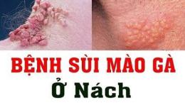 ảnh chụp màn hình trị da gà ở nách