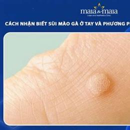 cách trị da gà ở tay