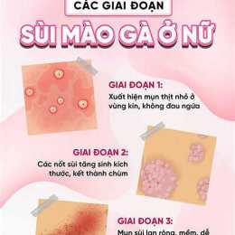 địa chỉ chữa bệnh sùi mào gà ở đà lạt