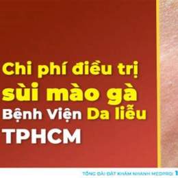 điều trị sùi mào gà tại bệnh viện da liễu