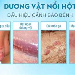 dương vật nổi hột như da gà