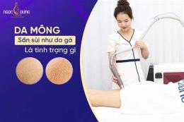 giao diện app cách trị da sần như da gà ở có