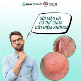 giao diện app chữa sùi mào gà ở da liễu trung ương