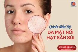 giao diện app da mặt nổi sần như da gà