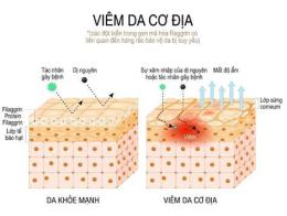 giao diện app viêm da cơ địa có ăn được trứng gà không