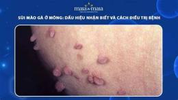 hướng dẫn sử dụng cách trị da gà ở mông