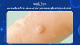hướng dẫn sử dụng cách trị da gà ở tay