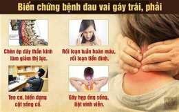 hướng dẫn sử dụng chèn ép dây thần kinh cổ gây tê tay