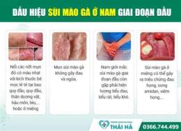 hướng dẫn sử dụng chua sui mao ga o benh vien da lieu trung uong
