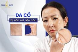 hướng dẫn sử dụng da cổ bị nổi sần như da gà