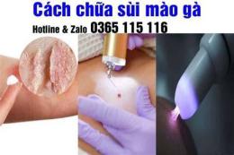 hướng dẫn sử dụng địa chỉ trị sùi mào gà ở đà nẵng