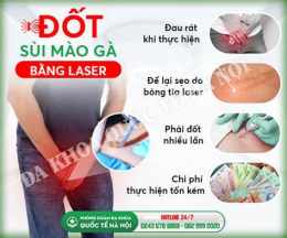 hướng dẫn sử dụng đốt sùi mào gà, bệnh viện da liễu