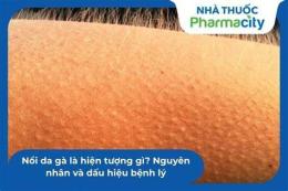 hướng dẫn sử dụng người hay nổi da gà là bị gì