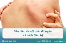 hướng dẫn sử dụng nổi mẩn da gà