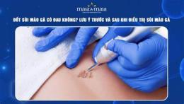 hướng dẫn sử dụng sùi mào gà đã đốt có lây không