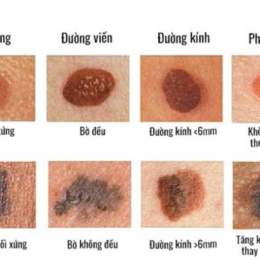 những hình ảnh nhìn nổi da gà