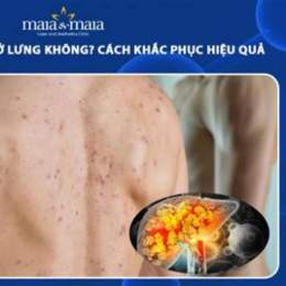 nóng nổi da gà