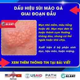 sui mao ga benh vien da