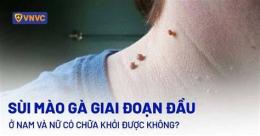 tính năng nổi bật cách chữa trị da gà ở cổ