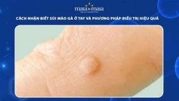 tính năng nổi bật cách trị da gà ở tay