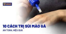 tính năng nổi bật chua sui mao ga o benh vien da lieu tw