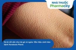 tính năng nổi bật da bị nổi da gà và ngứa