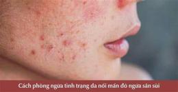 tính năng nổi bật da bi noi hot nhu da ga va ngua