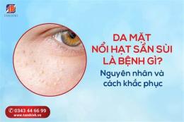 tính năng nổi bật da mặt nổi sần như da gà