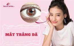 tính năng nổi bật gà mắt trắng dã