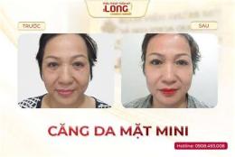 tính năng nổi bật lam cang da mat voi trung ga