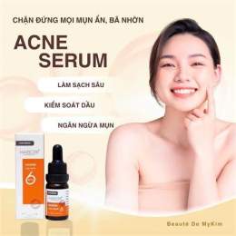 tính năng nổi bật mụn đầu trắng gần môi