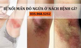 tính năng nổi bật nách bị da gà phải làm sao