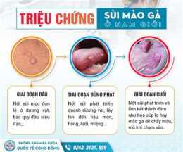 tính năng nổi bật nổi da gà ở dương vật
