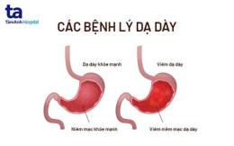 tính năng nổi bật viêm dạ dày có ăn được thịt gà không
