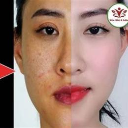 trắng da mặt với trứng gà