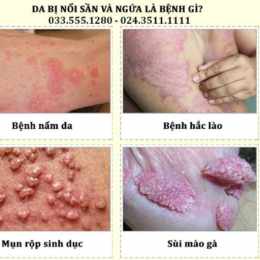 vùng da có bị sần sùi như da gà